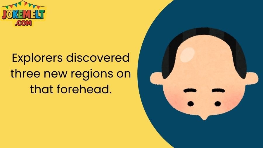 Big Forehead Jokes